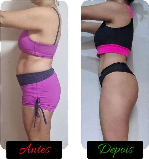 antes-e-depois-de-pessoas-png