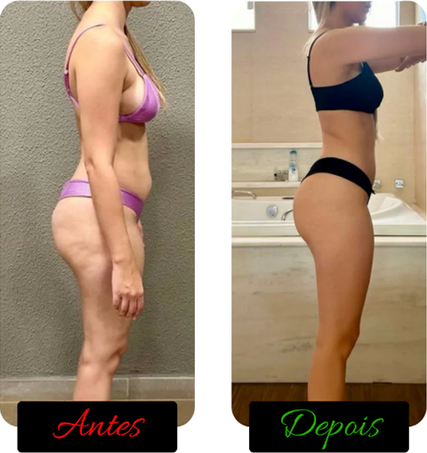 antes-e-depois-de-pessoas-png